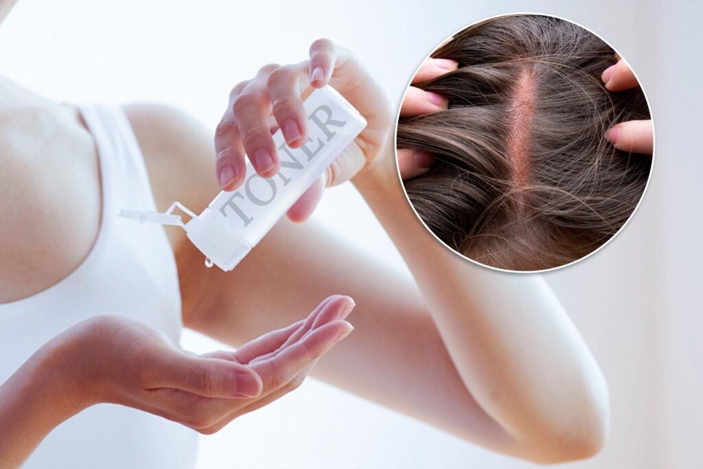 Why Does Toner Burn My Scalp? SheBonny